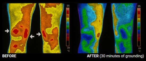BareEarth Grounding Mats Benefits