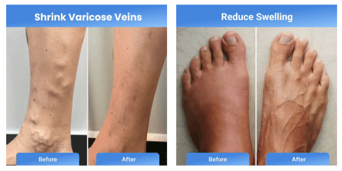 BubaSocks Compression Socks Benefits